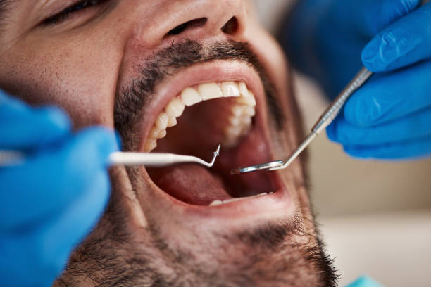 Best Cracked Tooth Emergency Dentist  in North Royalton, OH