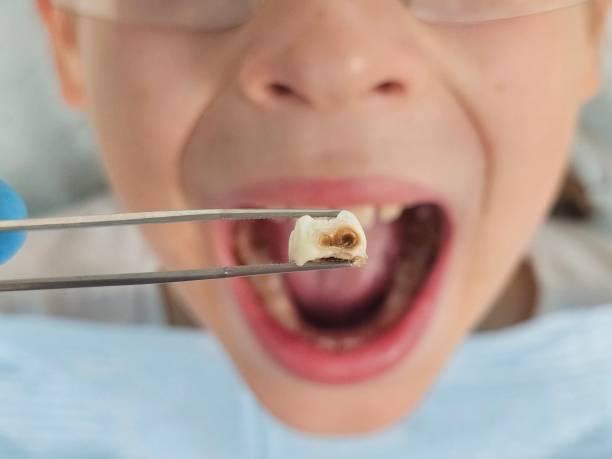 Best Tooth Infection Emergency Dentist  in North Royalton, OH